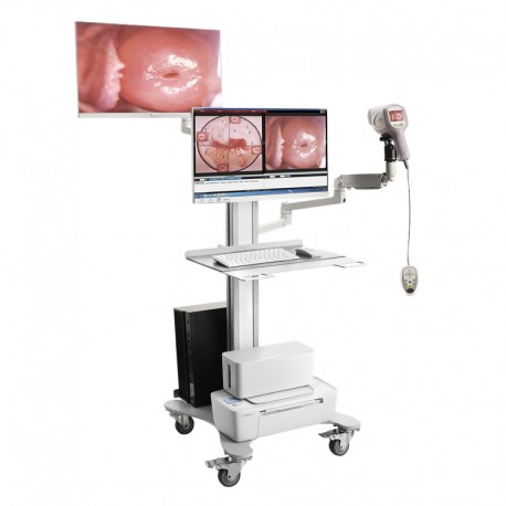 Video kolposkop KN-2200I HD